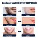 30 Tackable Beeswax Hair Removal Strips - Facial Wax Strips for Men | Effective Ingrown Hair Solution | International Shipping - Buy Online on GoSupps.com