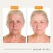 Buy ZOE Stem Cell Serum + EGF - Revitalize Skin | International Shipping Available - Buy Online on GoSupps.com
