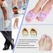 Gel Toe Separator & Stretchers - Overlapping Toes Corrector & Bunion Splint - Pain Relief for Yoga & Sports Activities - 2 Pairs - Buy Online on GoSupps.com