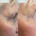 SKINICIAN Ageless Peptide Eye Complex - Anti-Wrinkle Eye Cream with Hyaluronic Acid & Vitamin C - Peptide Serum Eye Cream for Dark Circles - Stimulate Collagen Product - Vegan & Cruelty Free (15ml) - Buy Online on GoSupps.com