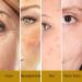 LaClaire Retinol Complex Face Serum 15ml - Anti-Aging & Brightening Neck/Facial Serum with Lactic Acid, Vitamin A & Retinyl Palmitate - Firm, Smooth & Nourish Skin - Anti Wrinkle Formula (Pack of 1) - Buy Online on GoSupps.com