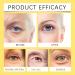 Snail Mucin Under Eye Patches - Collagen Eye Masks for Puffy Eyes - Snail Mucin Eye Pads - Under Eye Gel Patches Eye Masks Skincare for Dark Circle & Relaxing & Undereye Bags- 60 Patches - Buy Online on GoSupps.com