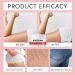 Buttock Care Cream - Moisturizing Nourishing Buttock Butter - Nourishing Hip Butter For Women Mothers Fitness Beauty Daily Routine After-Workout - Buy Online on GoSupps.com