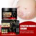 Cr me pour varices limination des varices r parateur de varices cr me pour varices jambes varices enflamm es 20 g 1 pi ce - Buy Online on GoSupps.com