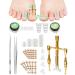 Ingrown Toenail Treatment Tools Professional Ingrown Toenail Removal Kit At Home Ingrown Toenail Corrector for Ingrown Toe Nail Correction Toenail straightener