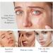 Acne Cream 50g Acne Treatment Gel 3% BHA Spot Cream for Acne Acne Spot Treatment Acne Moisturiser Face Dark Spot Remover for Face Spot Cream for Teenagers Acne Moisturiser Face acne face cream - Buy Online on GoSupps.com