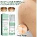 Acne Treatment Spary Back Acne Body Wash Aloe Soap for Face & Body Acne Marks Skin Care Spray Body Moisturiser For Acne Shoulder &Back Acne Reduce Back Acne& Nourishing-(Anti Acne Spray+Aloe Soap) - Buy Online on GoSupps.com
