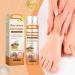 Bee Venom Nail Fungus Soothing Spray - Extra Strength Toenail Treatment (20ml) | Natural Nail Fungus Relief - Buy Online on GoSupps.com
