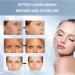 Wellnature Collagen Mask Set - Bio-Collagen Anti-Wrinkle & Hydrating Hydrogel Masks (4pcs) for Deep Skincare & Lifting | International Shipping Available - Buy Online on GoSupps.com
