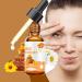 Buy Premium Honey Eye Drops | Stingless Bee Honey | Natural Eye Care Solution - Buy Online on GoSupps.com