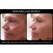 Instantly Ageless Anti-wrinkle 8 Hour Guarantee 5 Vials (15 Uses Approx) - Buy Online on GoSupps.com