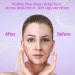 YourMate PhotoTherapy Device - High Frequency Facial Wand for Skin Tightening & Hair Care - Buy Online on GoSupps.com