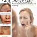 BotoxFace Serum Uk - Face Serum for Women - Boto Stock Solution Anti Aging Anti Wrinkle Face Serum - Botoserum in a Bottle Hydrating Serum - Hydrate & Smooth Skin Safe Effective 30ml - Buy Online on GoSupps.com