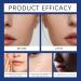TS TAC-SKY Face Serum Hydrating Moisturizing Facial Essence - Gentle Fast-Absorbing Reduces Dullness Boosts Elasticity Daily Use(1PCS) - Buy Online on GoSupps.com