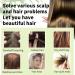Rosemary Oil for Hair Growth Natural Organic Rosemary Essential Oil and Derma Roller Diluted for Eyelash Beard Eyebrows Face Skin Care Hair Loss Treatment Nourishes The Scalp Improve Blood Circulation - Buy Online on GoSupps.com