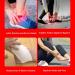 Buy SFKLYU Plantar Fasciitis Night Splint - Adjustable Ankle Support Brace for Optimal Relief | Breathable & Shock Absorbing Orthosis - Buy Online on GoSupps.com
