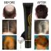Regrowth Organic Hair Serum Roller Set - Intense Roll-On Hair Growth for All Hair Types (3PCs) | Men & Women - Buy Online on GoSupps.com