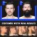Beard Growth Kit Scdom Grow a Beard Kit for Men with Titanium Derma Roller + Beard Growth Serum Oil + Beard Balm + Beard Cleansing Soap + Comb Beard Grooming Tool Kit Best Gift for Men/Dad - Buy Online on GoSupps.com