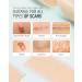 6-Pack Silicone Scar Sheets - Surgical Keloid Burn & C-Section Recovery - Reusable Medical Grade Strips for Optimal Healing - Buy Online on GoSupps.com