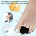 Reppkyh 20-Piece Fabric Broken Toe Wraps - Hammer Toe Straightener Splints - Cushioned Black Bandages for Friction Protection and Healing - Buy Online on GoSupps.com