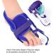 Bunion Toe Separator Left - Hallux Valgus Correction Toes Cover Corrector - Toe Straightening Spacer (Left) - Buy Online on GoSupps.com