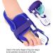 Adjustable Hallux Valgus Correction Toe Spreader | Bunion Corrector & Pain Relief Orthopedic Solution - Buy Online on GoSupps.com