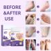2Pairs Lavender Feet Peeling Socks Foot Moisturiser Socks Foot Masks Remove Hard Skin Callus Remover For Feet Foot Mask For Dry Cracked Feet Exfoliating Foot Peeling Mask For Hard Skin Hand Foot Mask - Buy Online on GoSupps.com