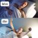 Nose Strips for Breathing & Snoring Relief - Airevolution Anti-Snoring Devices | Strong Adhesion & Spring Effect - 30 Count - Buy Online on GoSupps.com