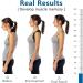 Meltor Intelligent Back Belt with Vibration Reminder - Adjustable Posture Correction for Men | Enhance Back Support & Alignment - Buy Online on GoSupps.com