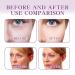 Facial Anti-Wrinkle Patches - Reduce Fine Lines & Smile Lines Overnight | International Shipping - Buy Online on GoSupps.com