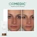 ORMEDIC Balancing Gel Masque by IMAGE Skincare Refresh Dry Skin with Organic Aloe Vera & Botanical Extracts - 2oz - International Shipping Available - Buy Online on GoSupps.com