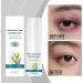  Zasdvn Eye Care Cream For Women | 30g Moisturizing Balm - Under Eye Bags Cream - To Moisturize Skin Reduce Goose's Feet Repair Dry Skin Eliminate Swelling - Buy Online on GoSupps.com
