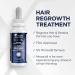 Head & Shoulders Scalp X Minoxidil for Men - Pack of 3 - 2 Fl Oz. - Buy Online on GoSupps.com