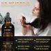 Rosemary Oil for Hair Growth Diluted Rosemary Oil for Hair w/Derma Roller Promotes Thicker Hair and Scalp Nourishment Hair Loss Treatment for men and Women Rosemary Biotin - Buy Online on GoSupps.com