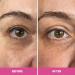 PrimeEyes Hydrate Under Eye Cream for Mature Women | Anti-Aging Dark Circle Treatment & Wrinkle Repair - Soft Glowing Under Eyes - Buy Online on GoSupps.com