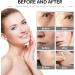 Face Moisturizer Face Cream Skin Care Beauty with Niacinamide & Retinol Removes Acne Redness Fade Dark Spots (100g) - Buy Online on GoSupps.com