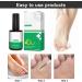 Liquide D' limination Des Verrues Liquide Anti Verrues S rums D' limination Des Acrochordons Pour Les Types De Peau 10ml - Buy Online on GoSupps.com