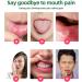 Mouth Ulcer Treatment Spray Mouth Ulcer Spray Mouth Ulcer Treatment for Adults Canker Sore Treatment Herbal Mouth Spray Breath Spray for Bad Breath Canker Relief Spray Mouth Freshener Spray 20ml - Buy Online on GoSupps.com
