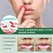 2pcs Mouth Ulcer Spray Mouth Ulcer Treatment Spray Canker Relief Spray Oral Ulcer Sprays Herbal Mouth Spray to Reduce Bad Breath Canker Sore Treatment Ulcer Breath Sprays Mouth Freshener Spray - Buy Online on GoSupps.com