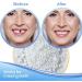 TEYSHA Temporary Tooth Repair Beads Kit - DIY Heat Fit Beads (50g) - Buy Online on GoSupps.com