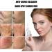 |Most Gifted| 2Pcs ReSkin Advanced Deep Anti-Wrinkle Serum - Collagen Boost Anti-Aging Serum - Anti-Aging Anti-Wrinkle Repair Collagen Serum - Instant Perfect Wrinkle Serum for All Skin Type - 30ml/1.01fl.oz - Buy Online on GoSupps.com