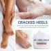 Urea Foot Cream Urea Cream 40 Percent For Feet Foot Cream for Cracked Heels and Dry Skin Urea Cream for Hand Foot and Body Care Deep Moisturizing Callus Remover Nourishes Soften - Buy Online on GoSupps.com