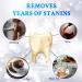 Non-Sensitive Teeth Whitening Strips Kit | Fast-Result Whitener - 28 Strips (14 Sets) - Peroxide Free - Buy Online on GoSupps.com