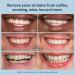 Auraglow Extra Strength Teeth Whitening Pen - 9% Hydrogen Peroxide | 40+ Fast Whitening Treatments | No Sensitivity | 4mL Whitening Solution - Buy Online on GoSupps.com