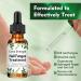 Fungal Nail Treatment 30ML - Extra Strong Solution for Toenails & Fingernails - Restores Healthy Nails - Protects Thick, Broken, and Discolored Nails - Green-1 - Buy Online on GoSupps.com