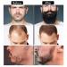 Beard Growth Kit - Derma Roller, Serum Oil, Balm & Comb Set for Stimulating Hair Growth - Perfect Gifts for Men - Buy Online on GoSupps.com