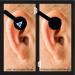 Combat Labs Cauliflower Ear Kit Variable Compression Reduction Cauliflower Ear Treatment Kit  - Buy Online on GoSupps.com