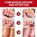 20ml Fungal Nail Treatment Serum Nail Strengthener for Damaged Nails Extra Strong Nail Fungus Treatment for Toenail and Fingernail Nail Polish Anti-Fungus Nail Repair and Strengthen Nail Repair Care - Buy Online on GoSupps.com