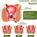 Hemorrhoids Relief Spray 30ml | Natural Treatment for Piles & Anal Fissures - Buy Online on GoSupps.com