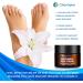 Antifungal Skin Cream 30g - Athlete's Foot, Nail Fungus, Jock Itch, Ringworm & Eczema Treatment for Men - Buy Online on GoSupps.com